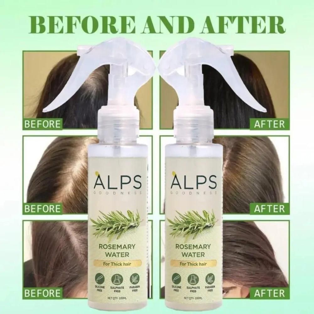 hair regrowth spray for women